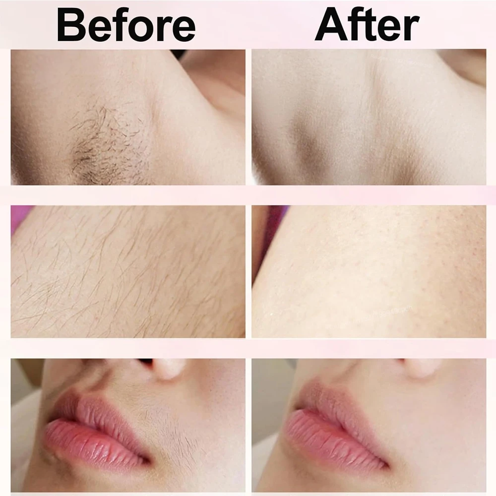 Electric Shaver for Women Portable Mini Rechargeable Epilator Female Painless Electric Razor Women's Dual Head Bikini Trimmer - Image 6